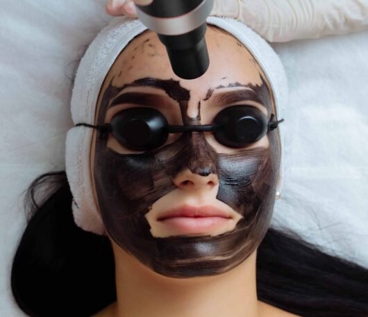 Carbon Facial