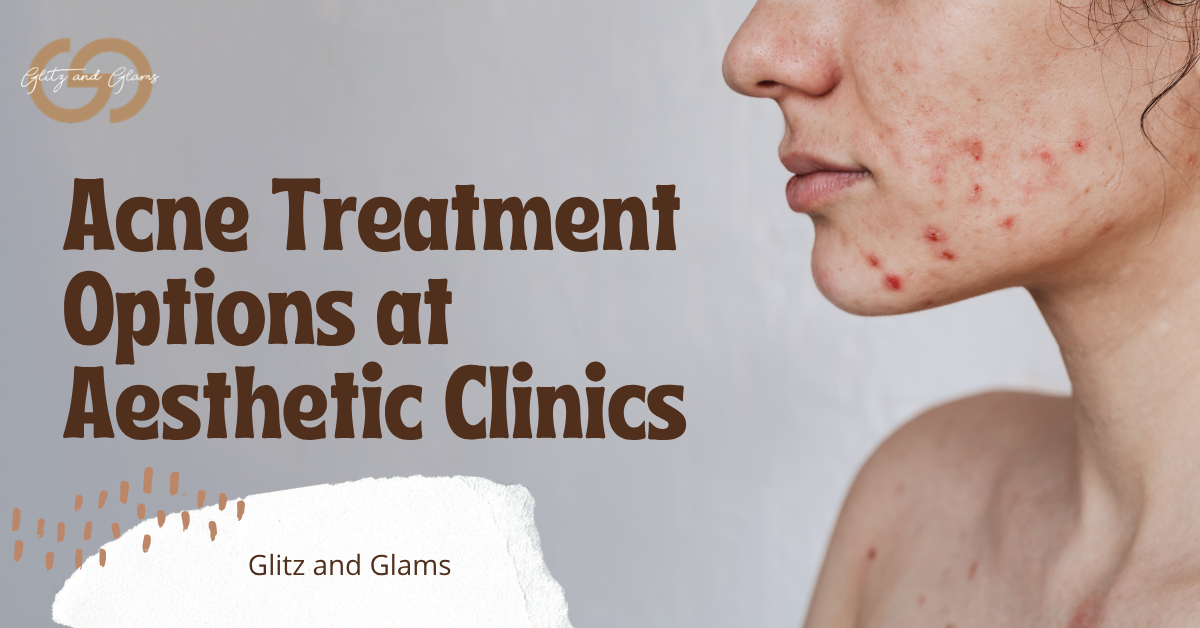 Acne Treatment Options at Aesthetic Clinics Acne Treatment