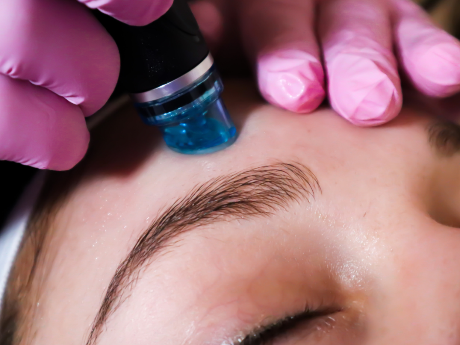 hydra facial (1)